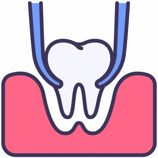 Tooth Extractions