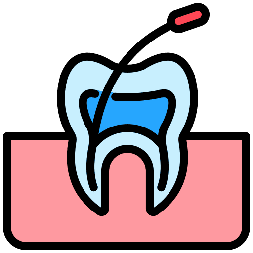 Endodontic Treatment