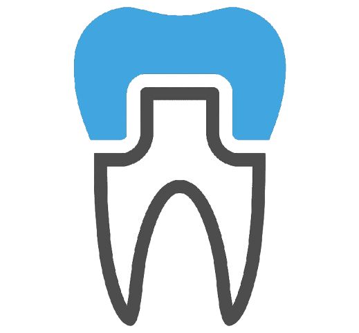 Dental Crowns & Bridges